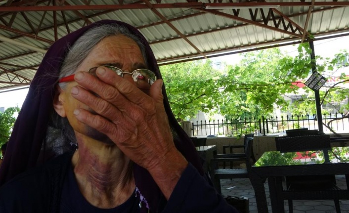 Koyununu İsteyen 70 Yaşındaki Kadını Darp Etti
