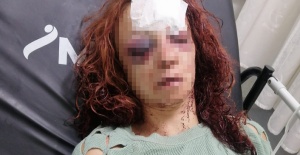 Mersin'de kadını bıçakla ve darbederek yaralayan zanlı ile arkadaşı tutuklandı